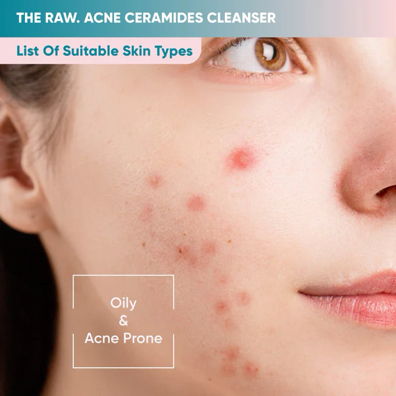 Acne Ceramides Cleanser - Image 5