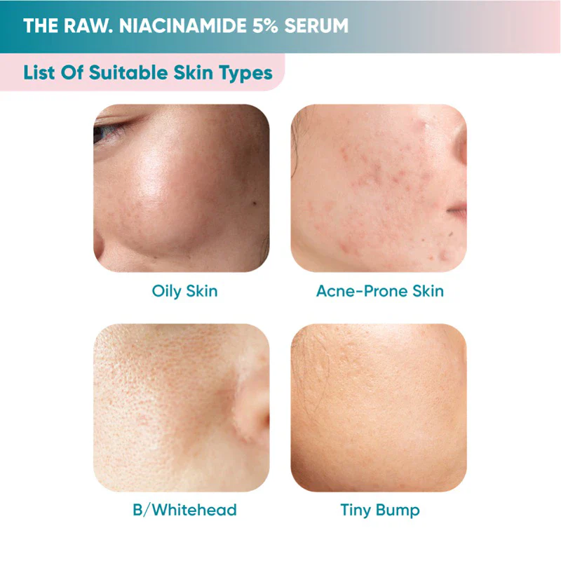 Niacinamide 5% Serum - Oil, Acne & Blemish Control 15ml/30ml - Image 5