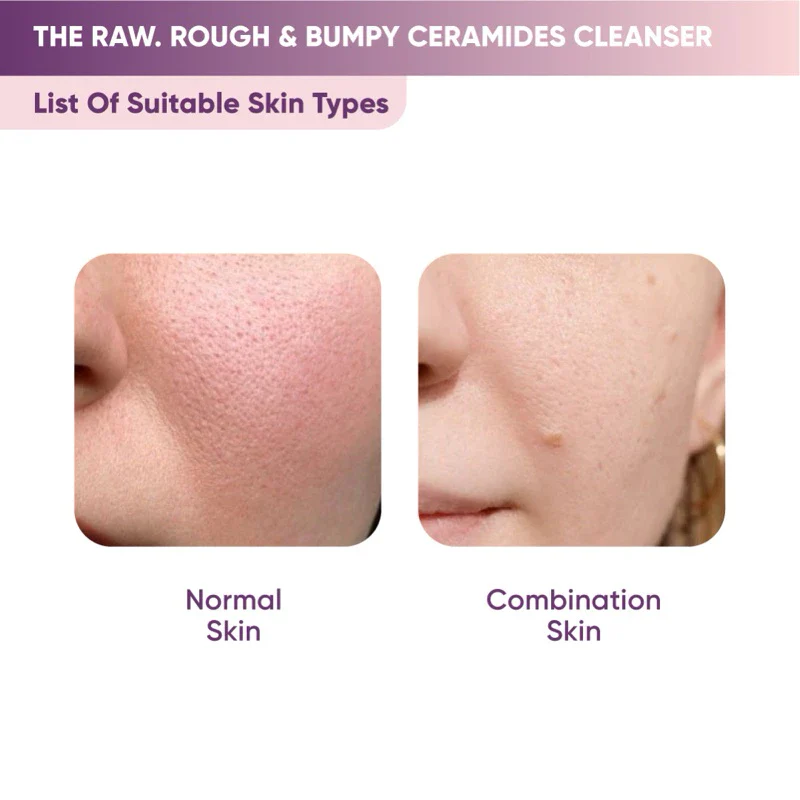 Rough & Bumpy Ceramides Cleanser - Image 5